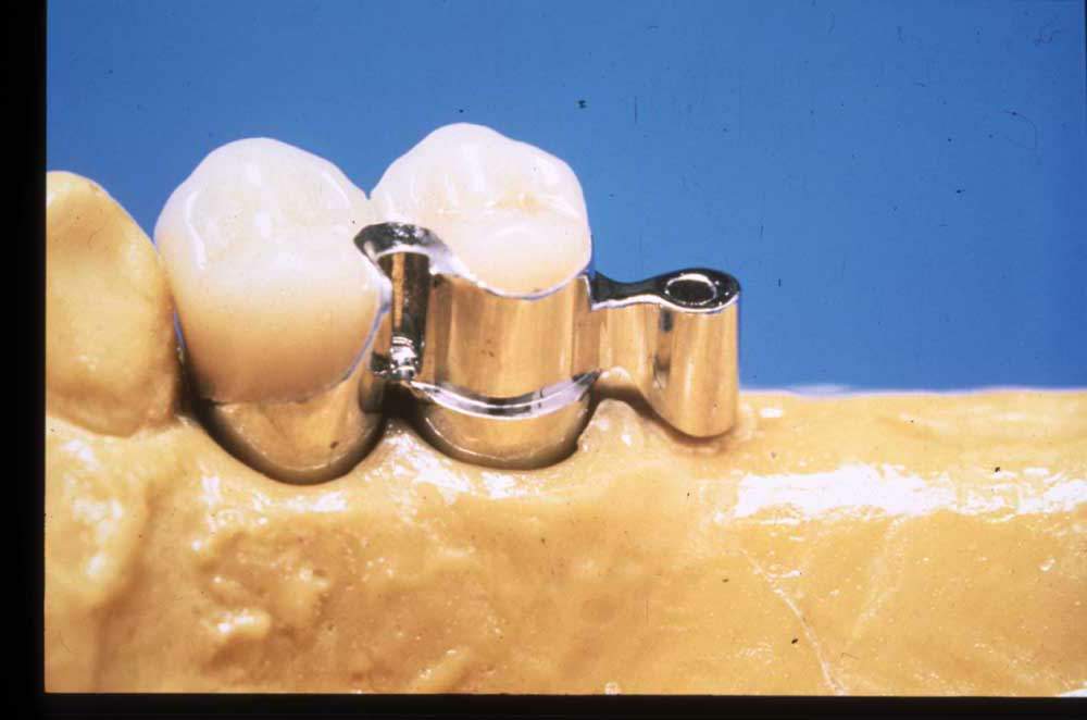 part perno sup copia.JPG (55666 byte)