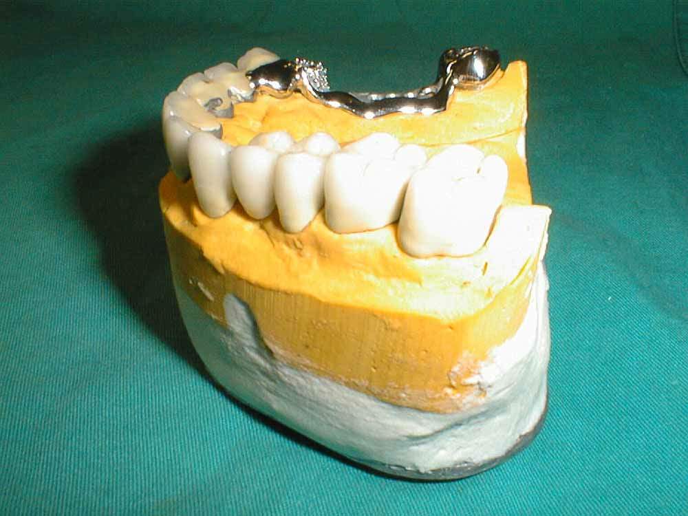 sup_monolaterale2.JPG (75518 byte)