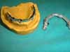 sup_overdenture5 copia.JPG (4600 byte)